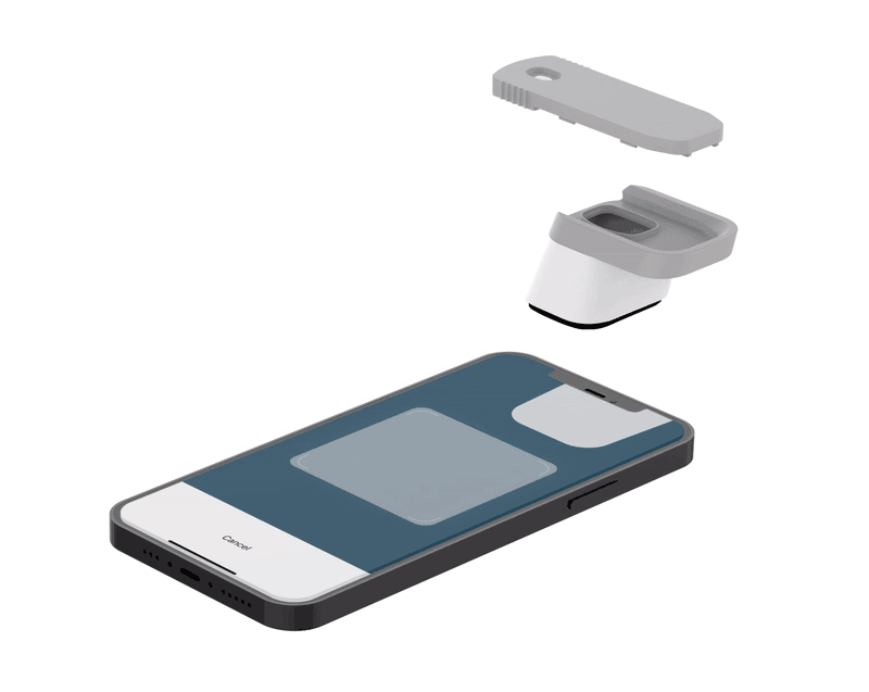 iXensor proactive health management